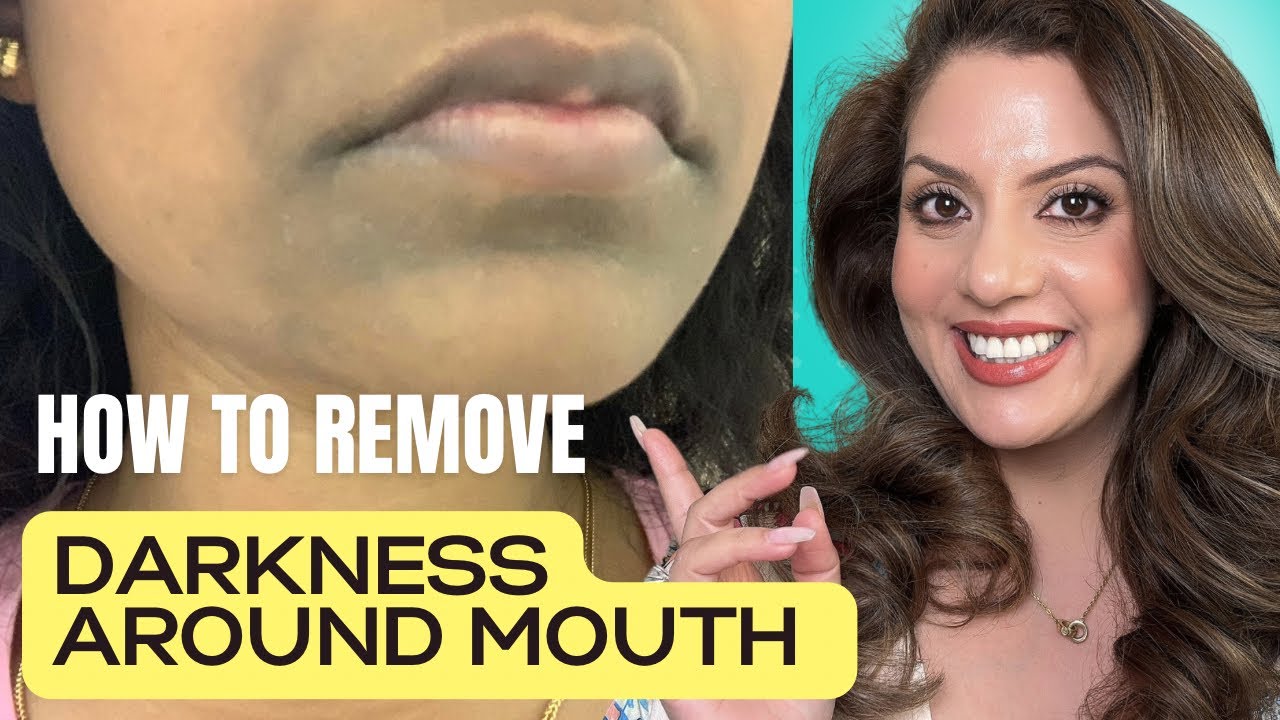 How to Remove Darkness Around Mouth Naturally | Easy Home Remedies for Clear Skin | Nipun Kapur