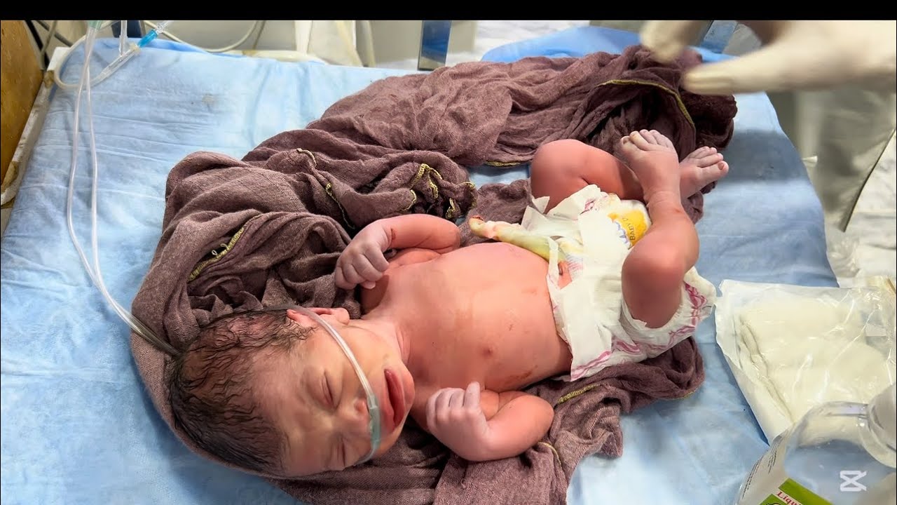 Critical Baby Received in NICU | Oxygen Support & IV Line Passed  Condition Improved After 7 Minutes