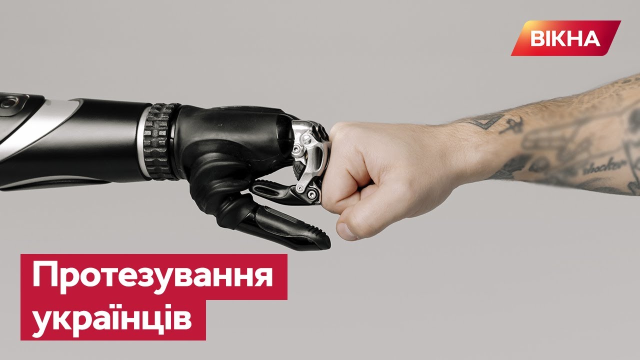 ⚡️ Повернутися до життя — як ДОПОМОГТИ тим, кому потрібен ПРОТЕЗ | Незламні українці