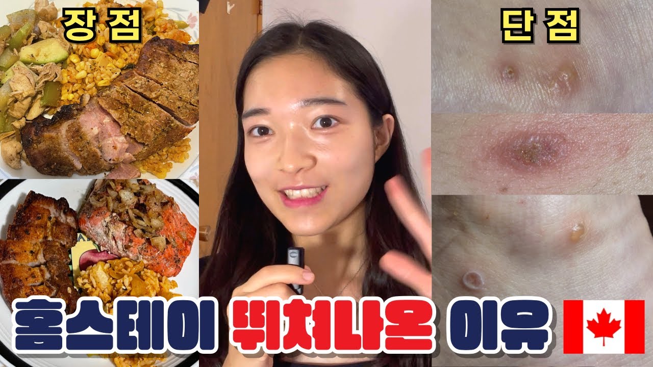 캐나다 홈스테이 후기. 밥이 잘 나와도 뛰쳐나올 수 밖에 없었던 현실ㅣ🇨🇦캐나다에서 살아남기 Ep.5