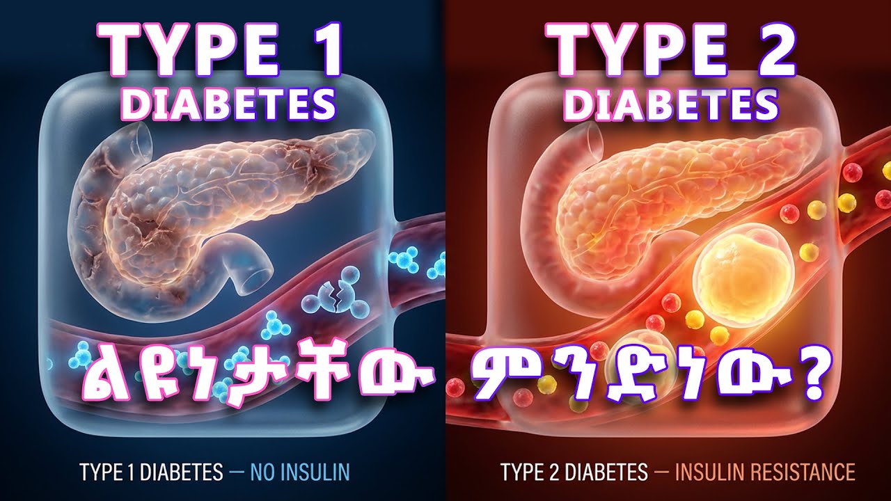 ስኳር በሽታ - ታይፕ 2 ለምን ኢንሱሊን ብቻውን አይሰራም? | Type 1 and 2 diabetes ልዩነታቸው ምንድነው  እና መፍትሄው?!