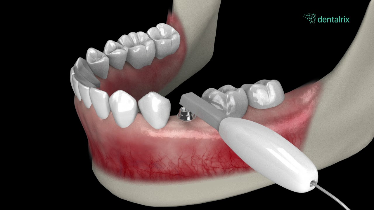 Dentalrix 190702