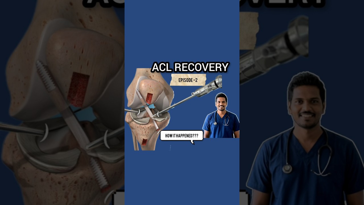 Episode-2 |How my ACL injured while Javelin throw #aclinjury #aclrehabilitation