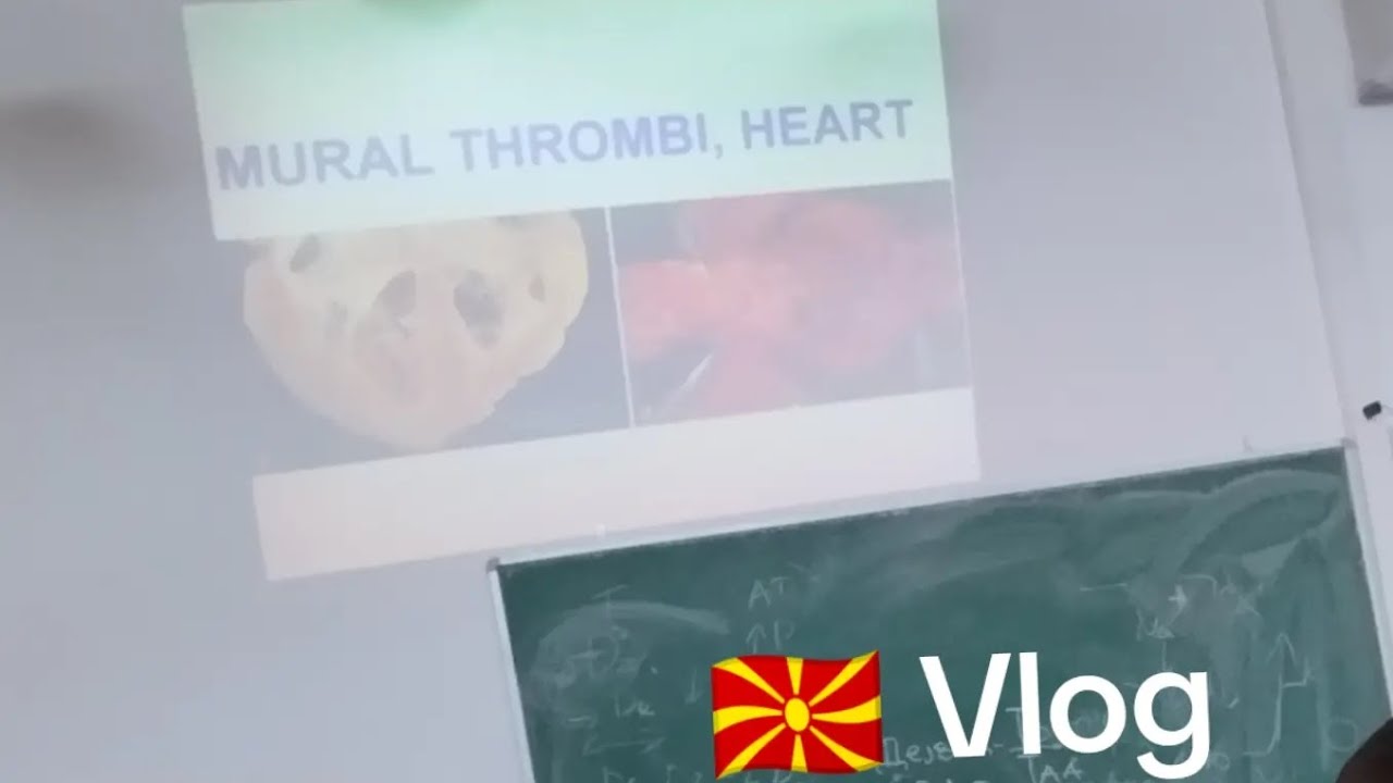 Stip Vlogu (Goce delchev &uuml;niversitesi ve iştip şehir vlogu)
