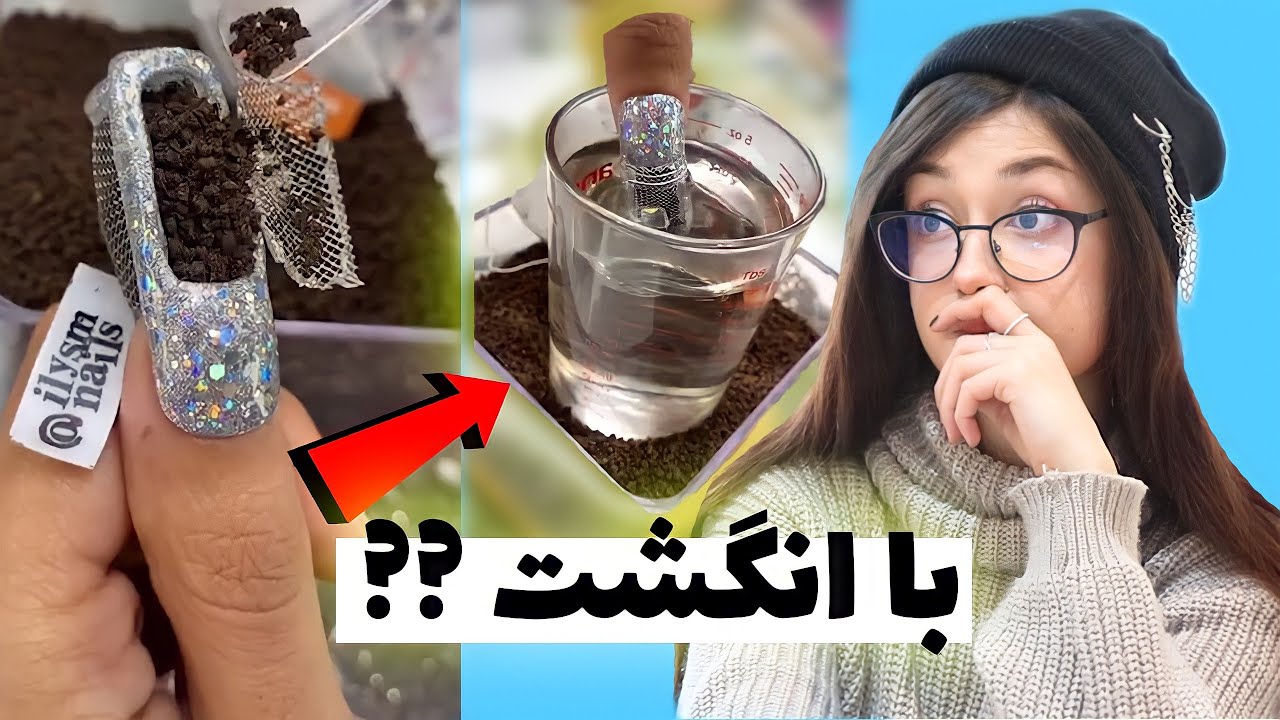 انگشتمو به فنا دادم !! || I HATE TIKTOK !!!