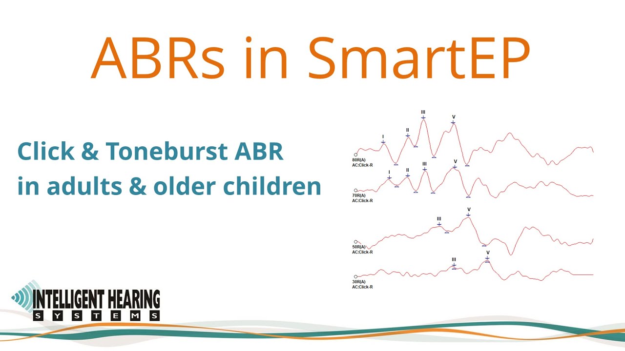 Adult ABR Training - Acquiring Click and Tone Burst ABR using SmartEP and Duet Platform