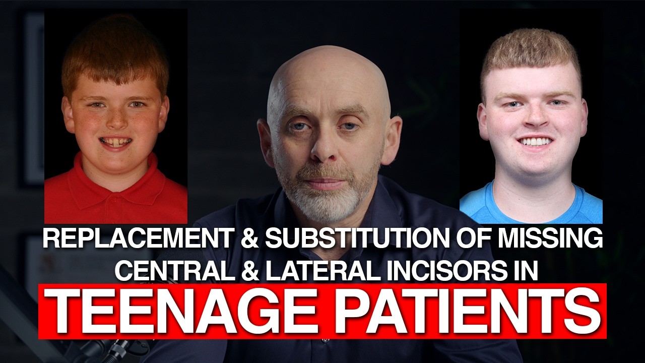 Replacement & Substitution of missing incisors in teenage patients | Orthodontics by Dr. Kieran Daly