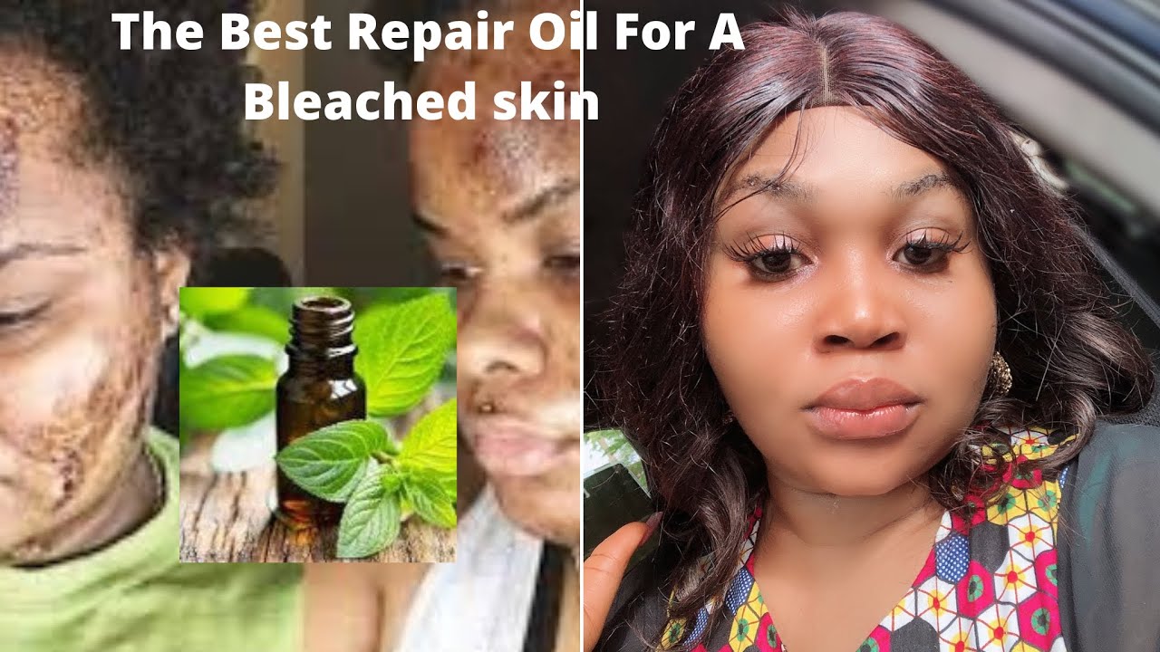 How To Repair Bleached Skin || How To Make Effective Repair Oil For A Bleached Skin