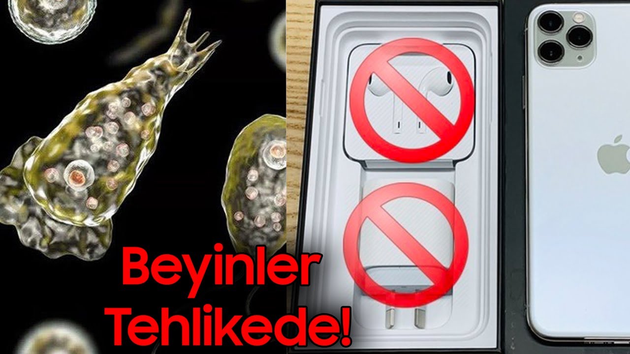 BEYİN YİYEN AMİP ORTAYA &Ccedil;IKTI, APPLE ŞARJ CİHAZLARINI KALDIRIYOR! - Teknoloji Haberleri #104