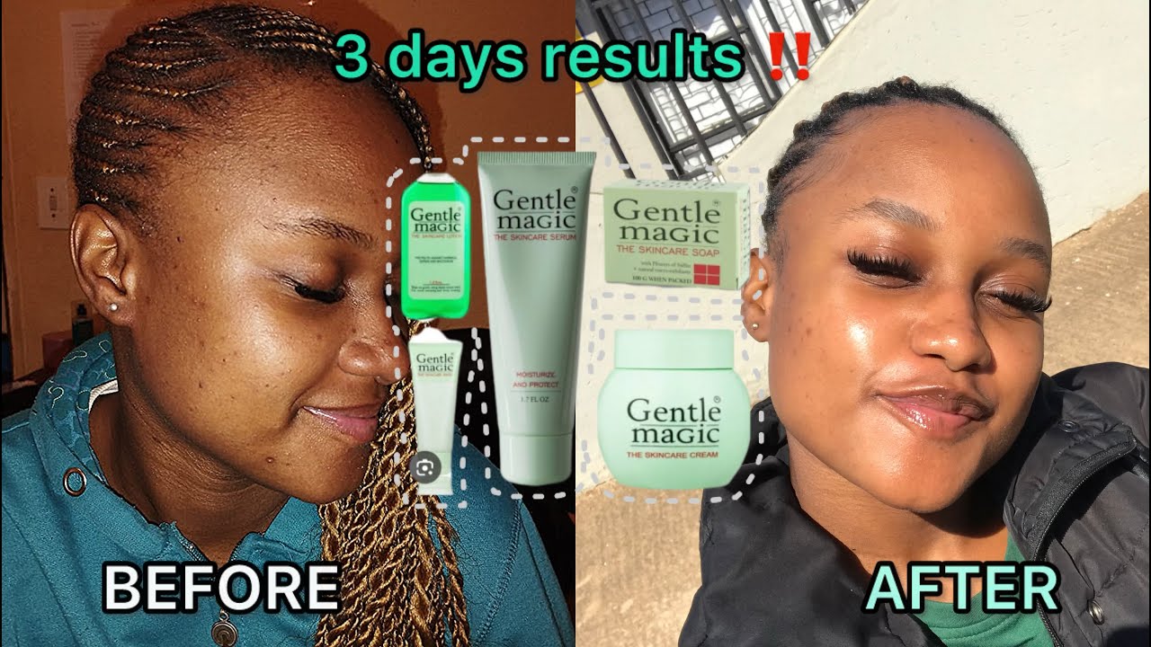 It WORKED for me , This is what you need to Do everyday