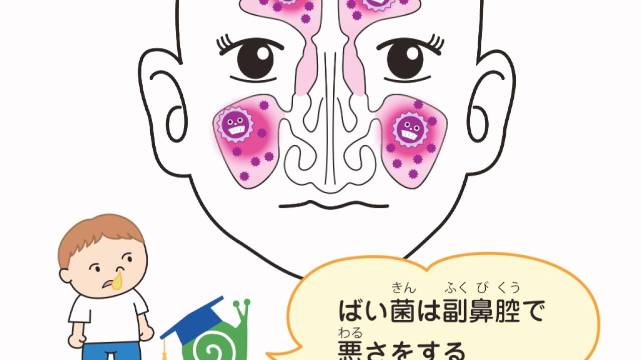 副鼻腔炎 - 坂井耳鼻咽喉科 病気の説明動画