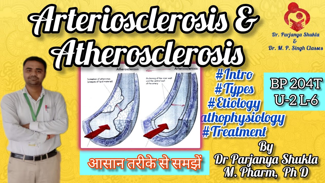 Arteriosclerosis and Atherosclerosis | Intro, Types, Etiology, Pathophysiology| BP 204T U-2 L-6