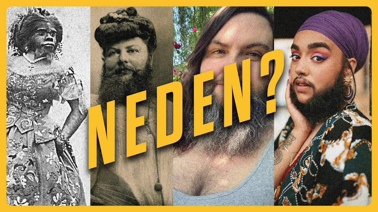 SAKALLI KADINLAR? - Bir Hastalığın Hayatlara Dokunuş Hikayesi