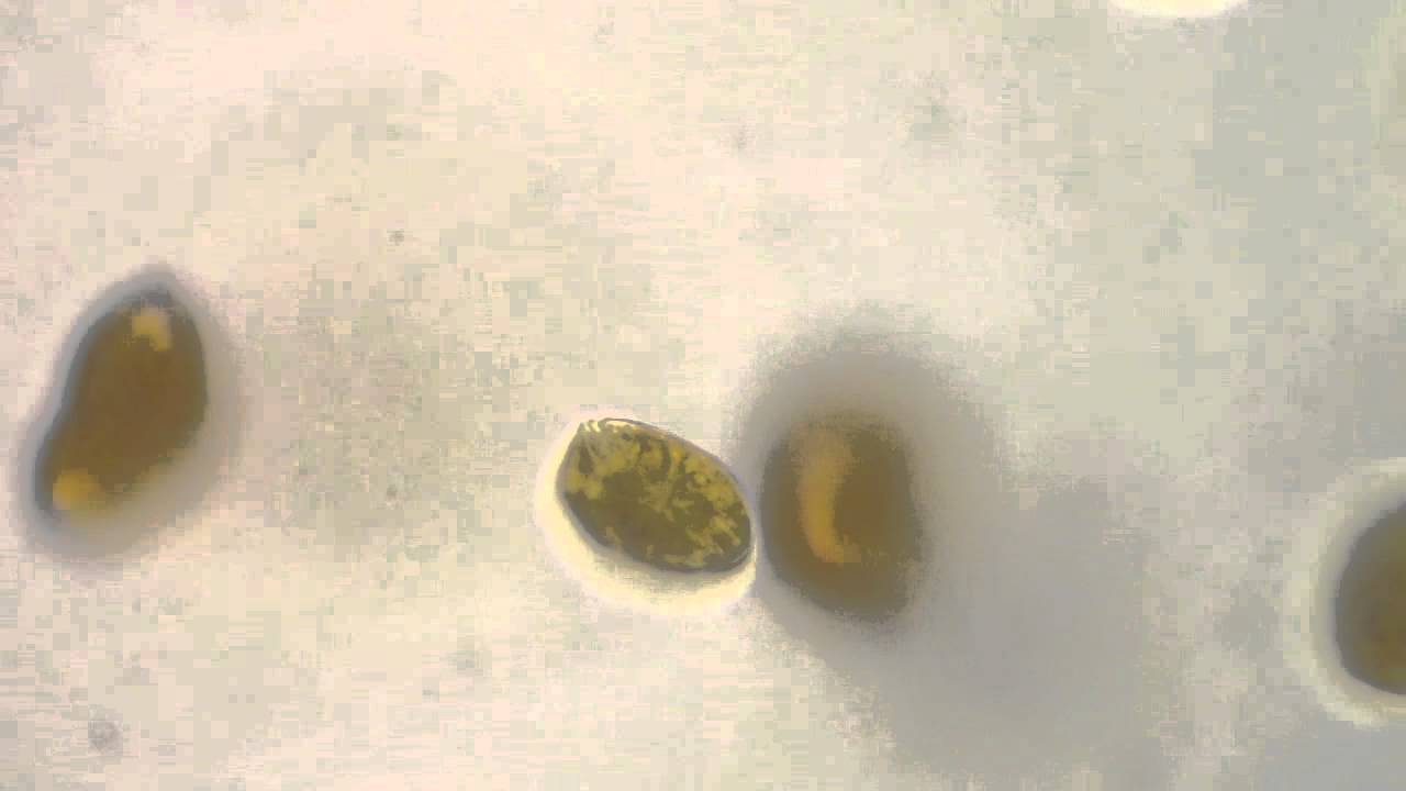 Ostreopsis sp. 400X
