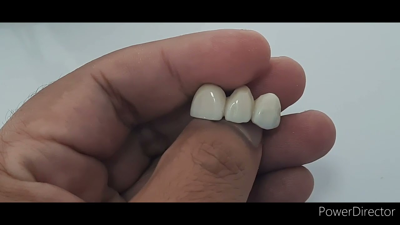 Prótesis dental fija ivocron 2021