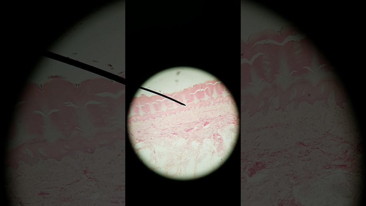 Meissner's and Pacinian corpuscle histology
