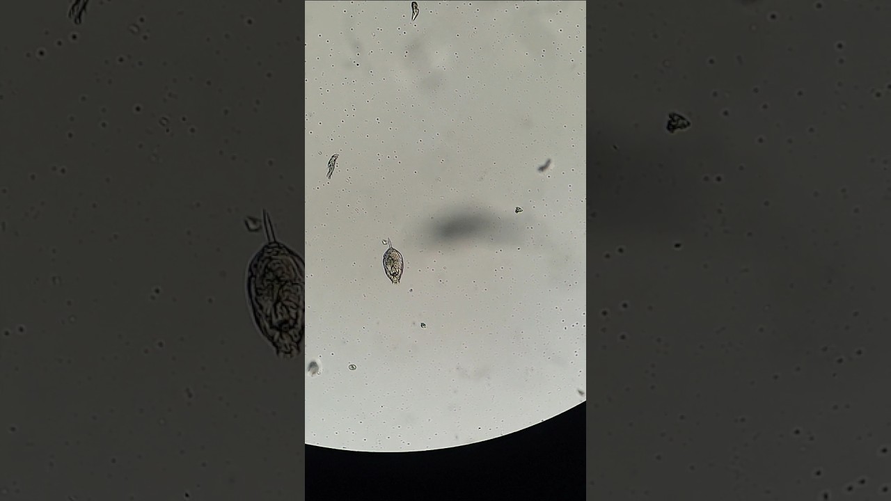 Under microscope 