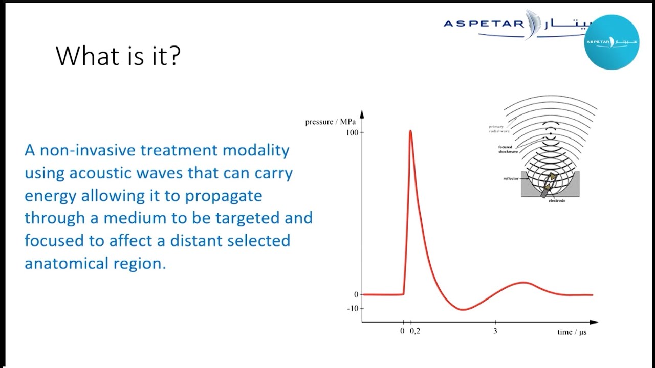 Focal Extracorporeal Shockwave therapy (ESWT) in Sports – Innovation at Aspetar - Dr Aston Ngai