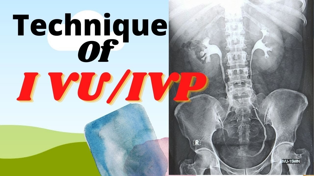 Technique of IVU/IVP (Ep-36) |Intravenous urogram/pyelogram |Procedure of  IVU/IVP test |