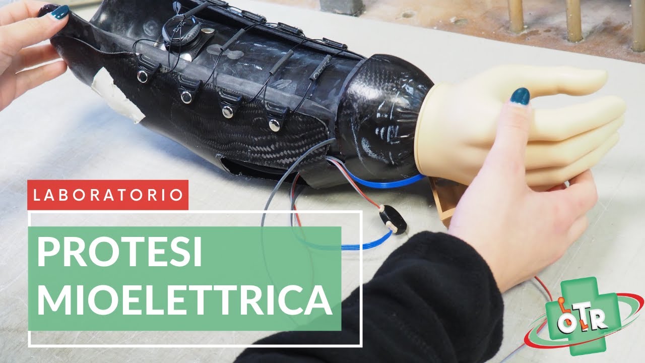 OTR Ortopedia - LABORATORIO - Mano Mioelettrica Transcarpale
