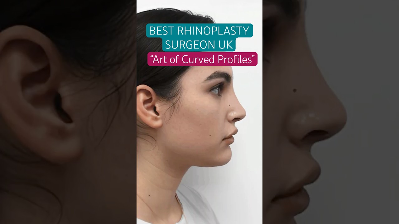 Best Rhinoplasty Surgeon London | 25-Year-Old Nose Refined with Subtle Curve by Mr. Taimur Shoaib