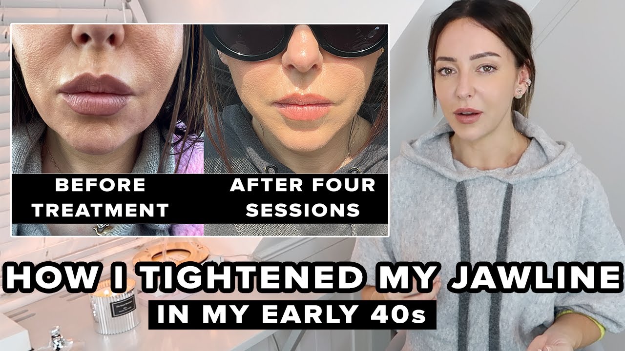 Early 40s: How I Tightened My Jawline Non-Surgically at Home / CurrentBody RF Device