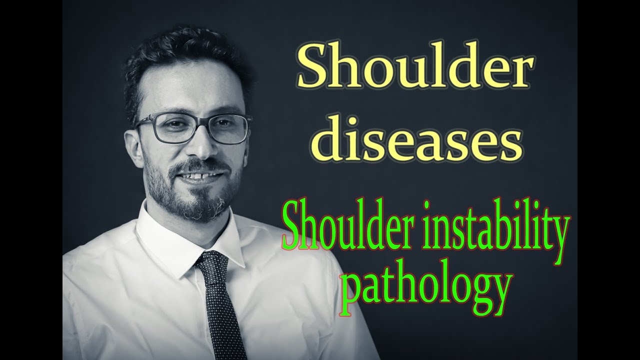 02  Shoulder diseases: Shoulder instability pathology