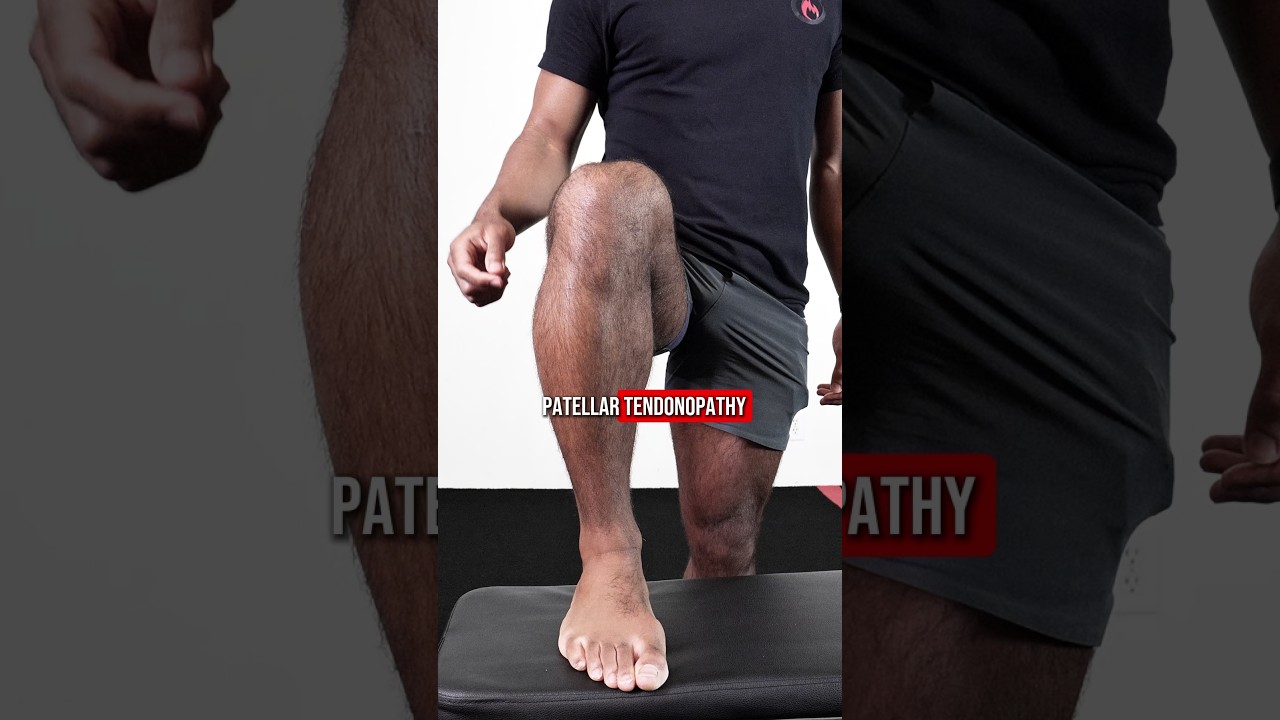 Jumper&rsquo;s knee pain in under 20 sec | Patellar tendinopathy signs + causes #jumpersknee #kneepain
