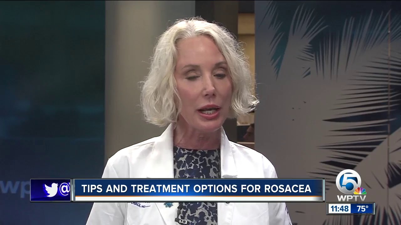 Tips and treatment options for rosacea