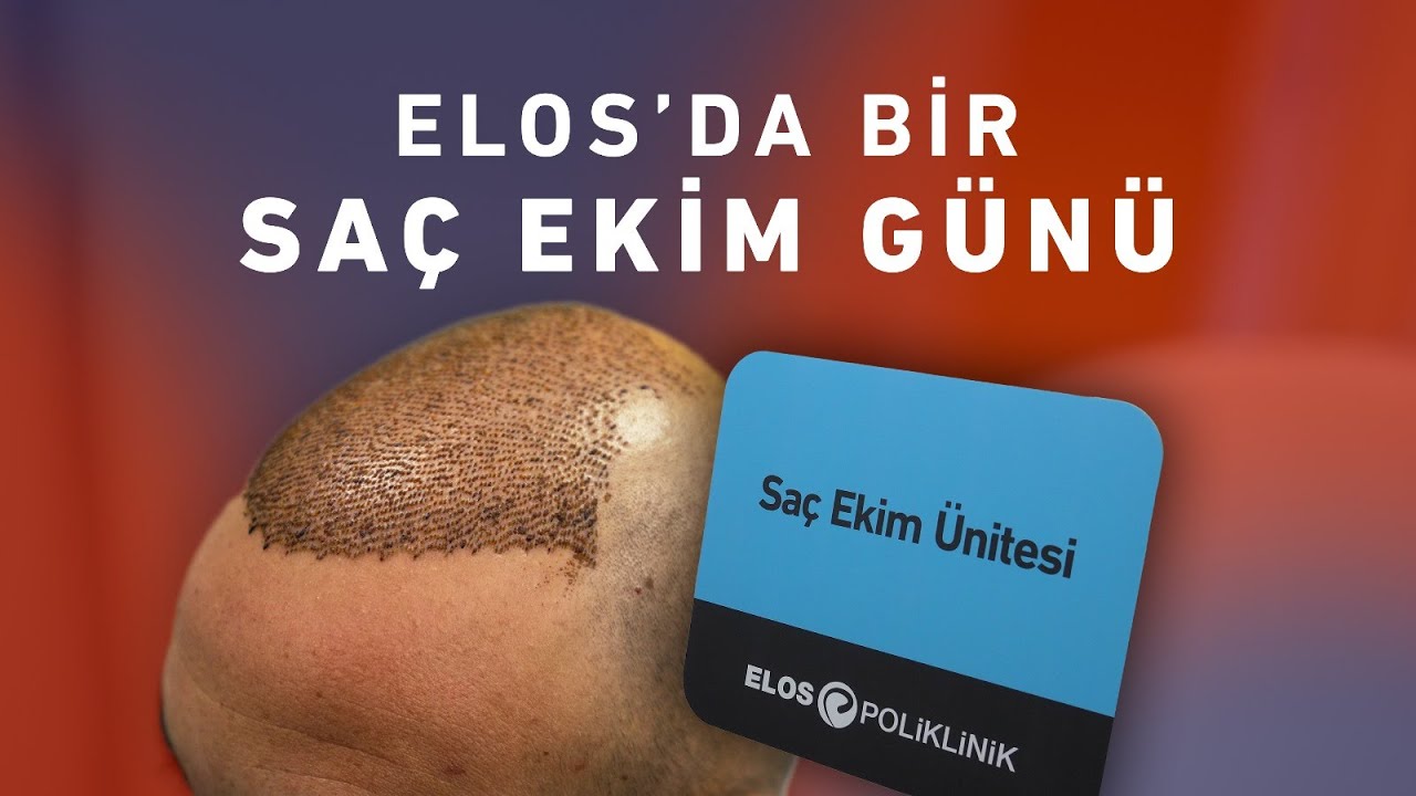 Elos Klinikte Sa&ccedil; Ekimi