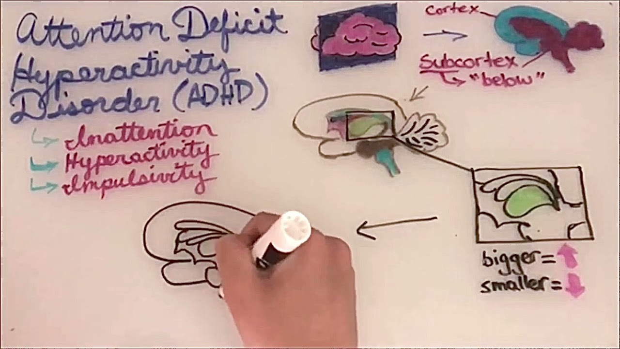 Subcortical structures in people with ADHD