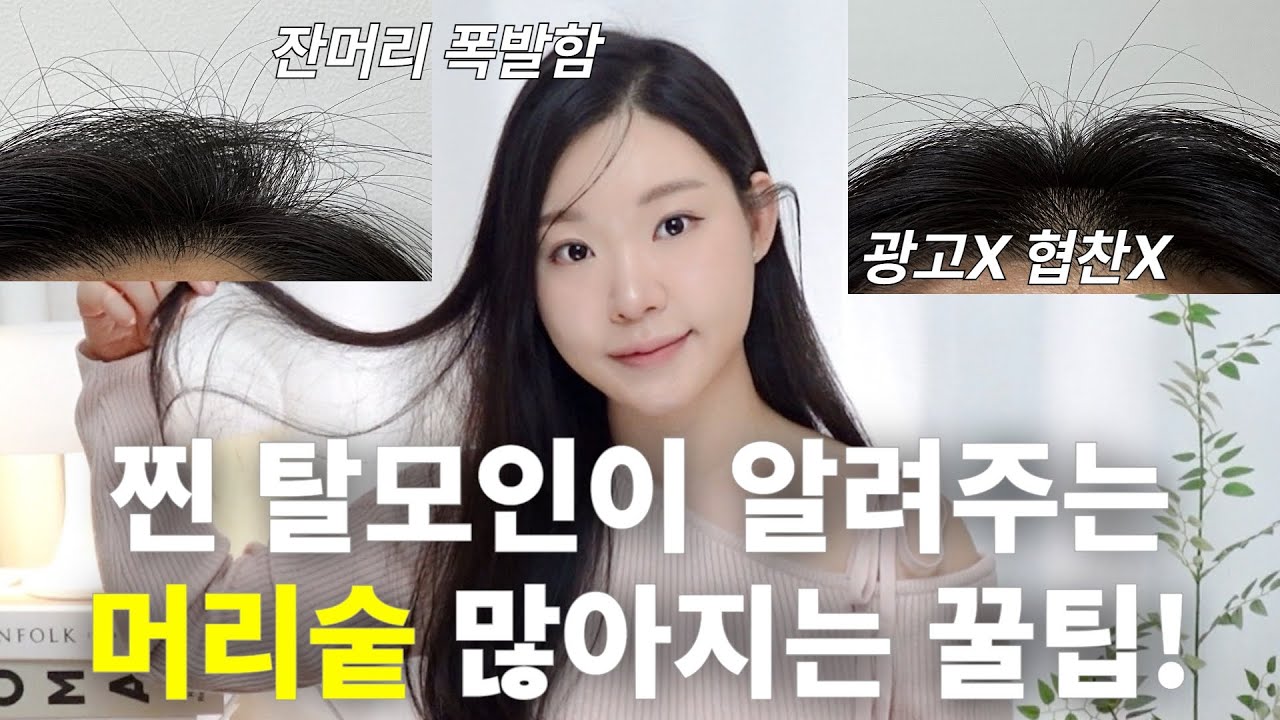 광고❌ 찐 탈모인이 말아주는,, 머리숱 실제로 많아지는 2가지 방법! 두피오일마사지 하는 법, 모낭자극제