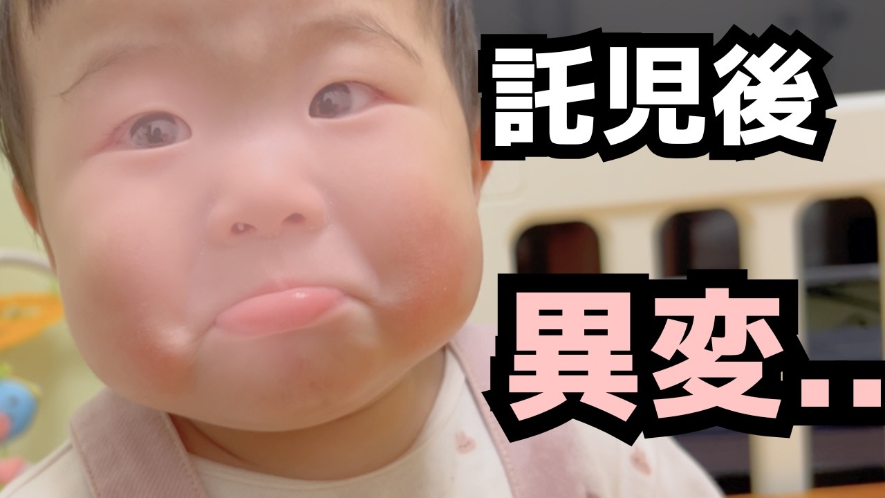 託児所に預けたら、様子がおかしくなった【9ヶ月】