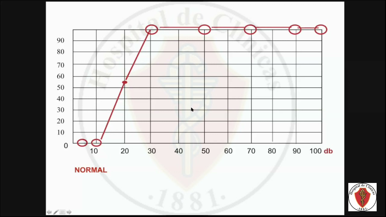 03/03/2021 Logoaudiometría