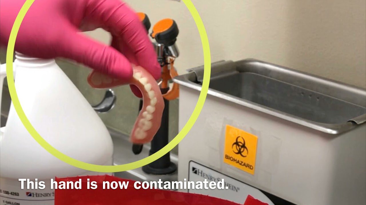 Cleaning a Denture in Clinic