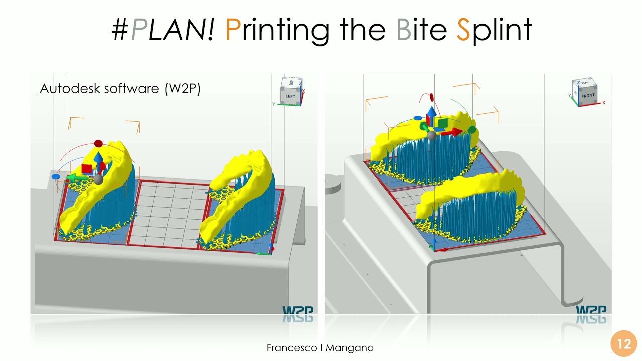 Essentials of Digital Dentistry- #PLAN!- Video 19