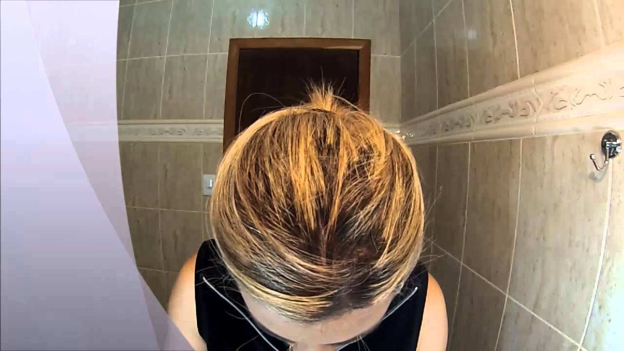 Minha bijuteria escureceu e agora?