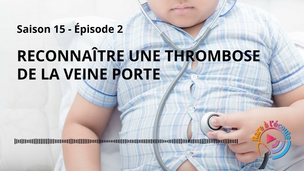 Maladie rare - Reconnaître une thrombose de la veine porte