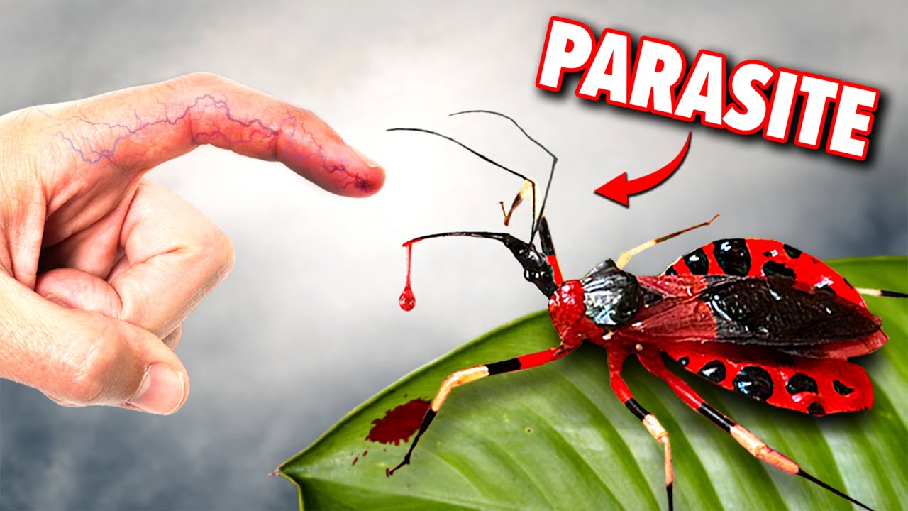 Assassin Bug Bite Sends Me to Hospital!