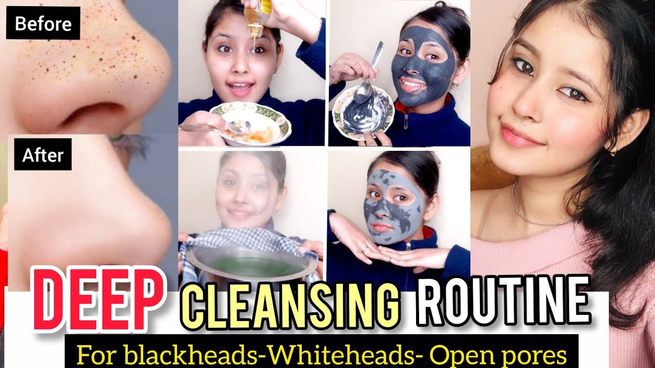 In 7 Days--No More Blackheads / Whiteheads / Open Pores 😍 DEEP CLEANSING ROUTINE | Kiran Tutorialz