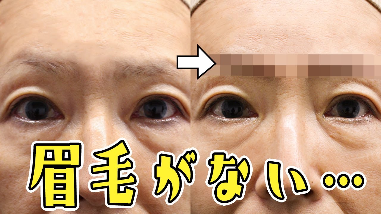 「眉毛がない…(63歳)」眉アートメイクで驚きの若返り【施術密着】