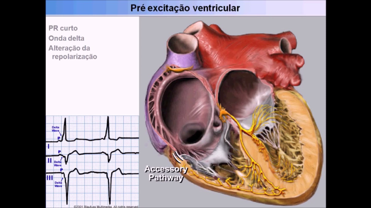 5 minutos de ciência Cardiologia - Como tratar Arritmias em neonatos. @arritmiaonline
