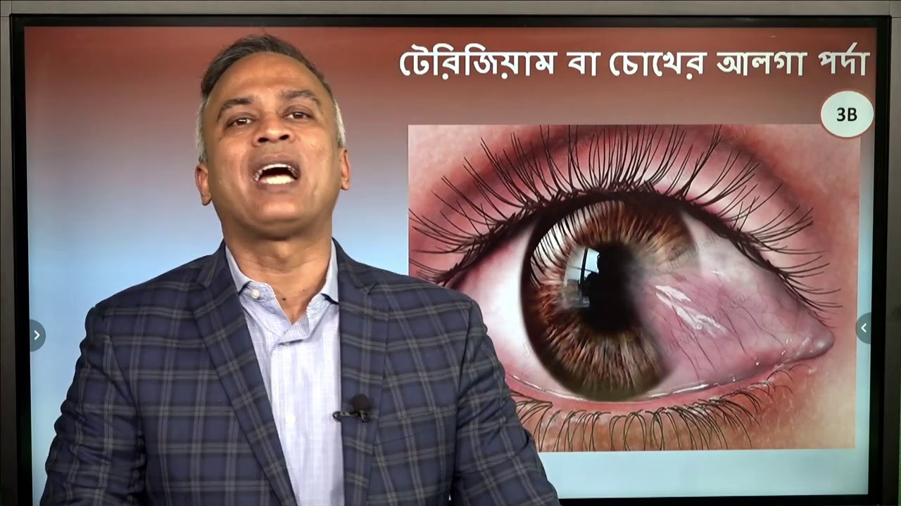টেরিজিয়াম বা চোখের আলগা পর্দা