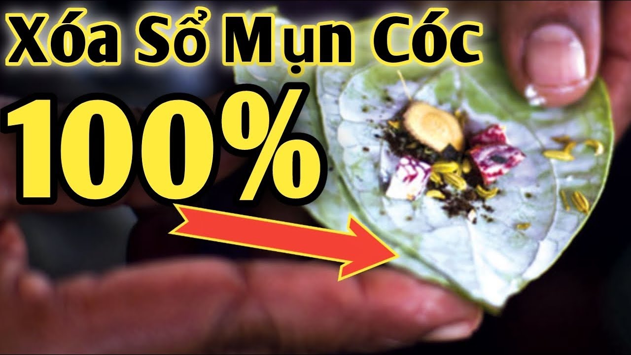 Trị Mụn Cóc chỉ 1 nốt nhạc. PHAN HẢI Channel