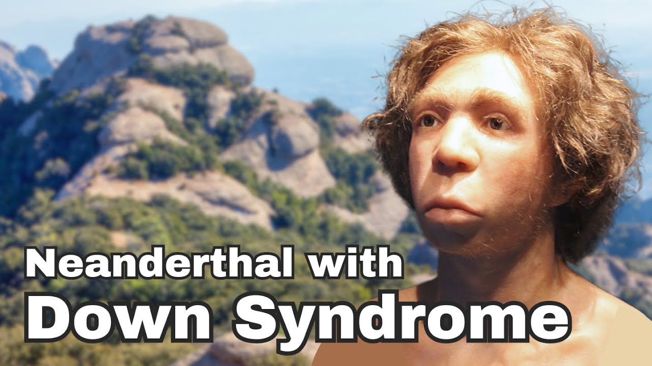 Scientists found a Neanderthal with Down Syndrome