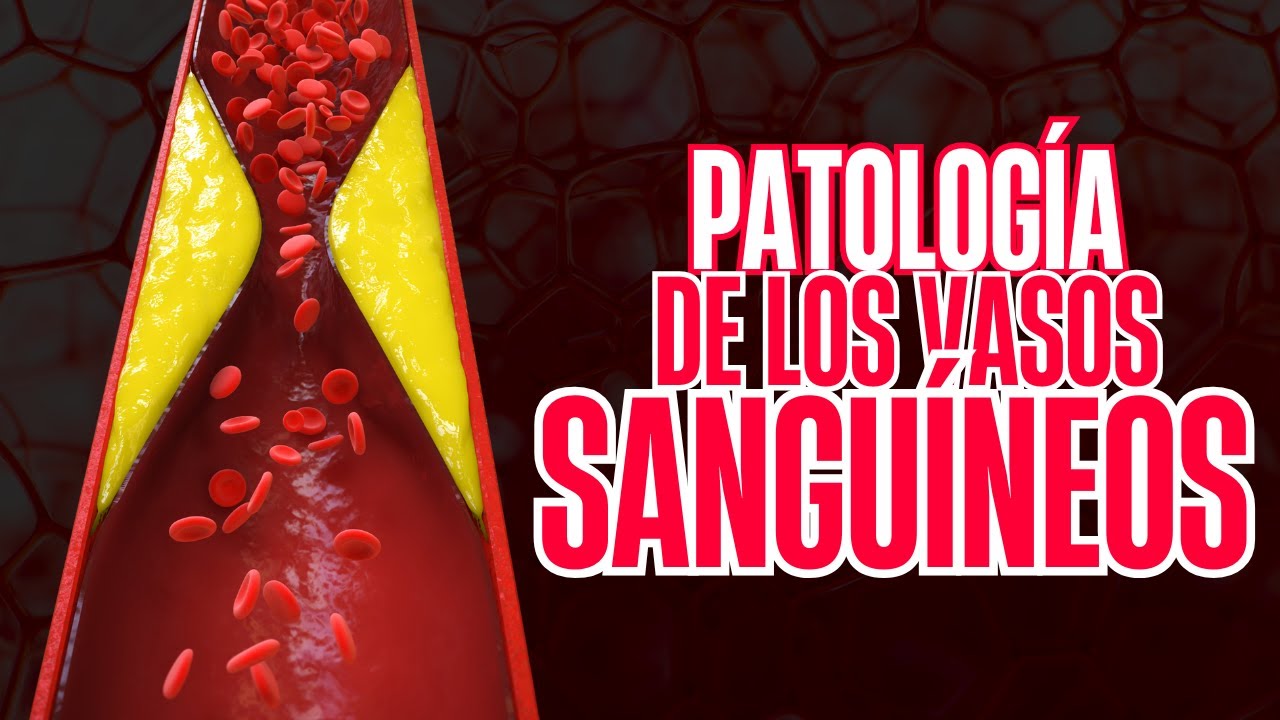 Emisión en directo - Patología de los vasos sanguíneos - Parte 2 - Patología 2025B