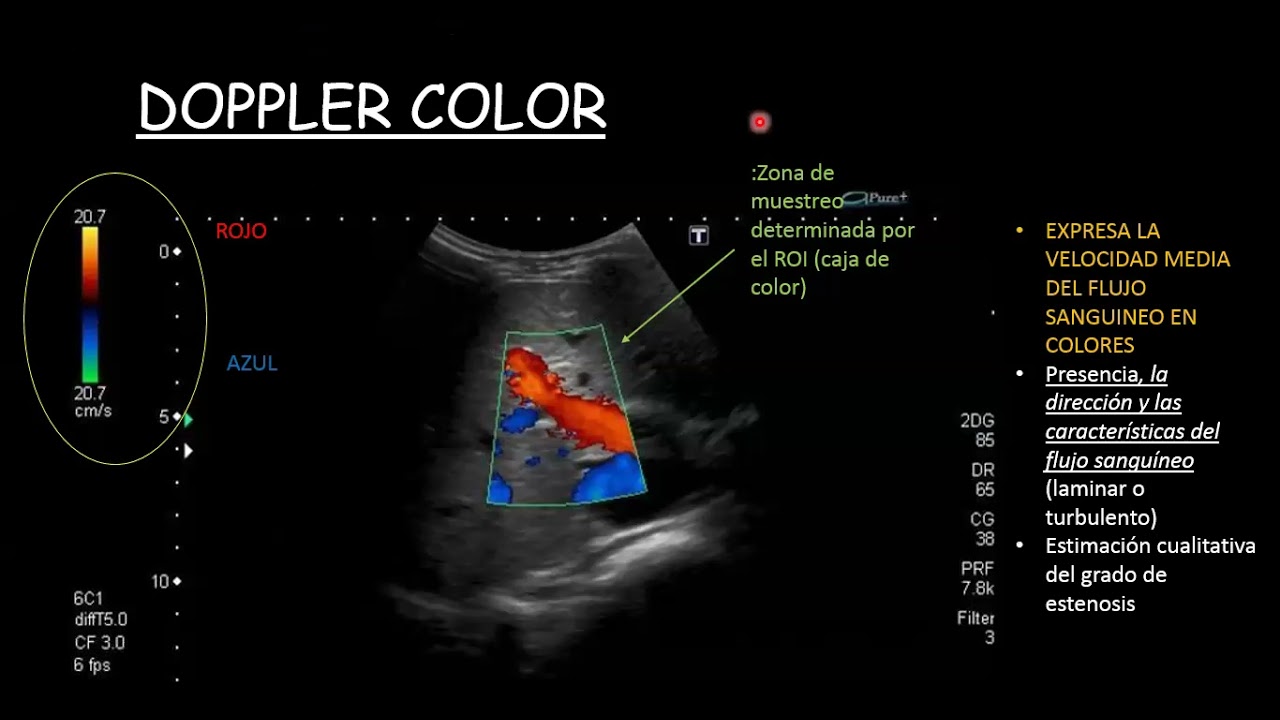 BASES FISICAS DE ECOGRAFIA DOPPLER