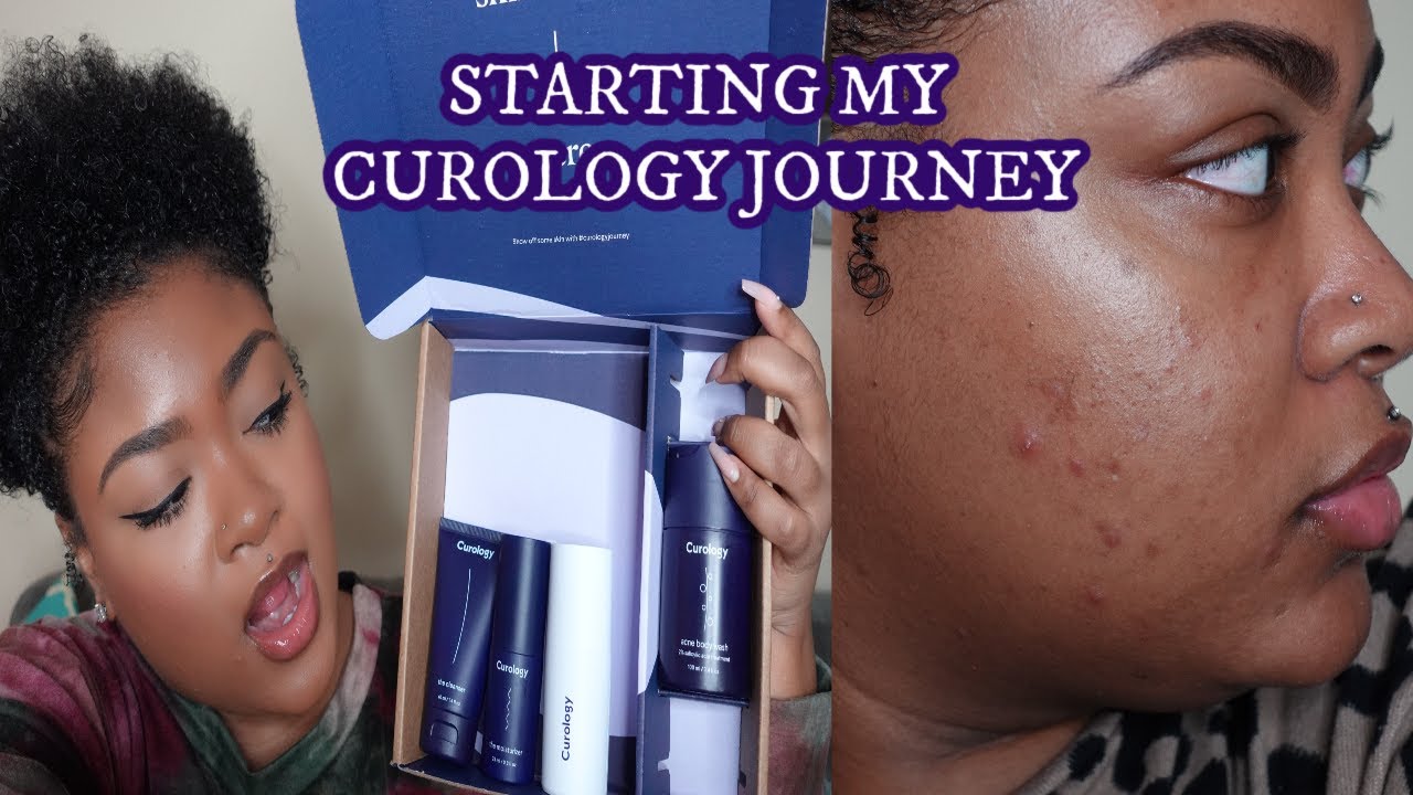 My Journey With Curology