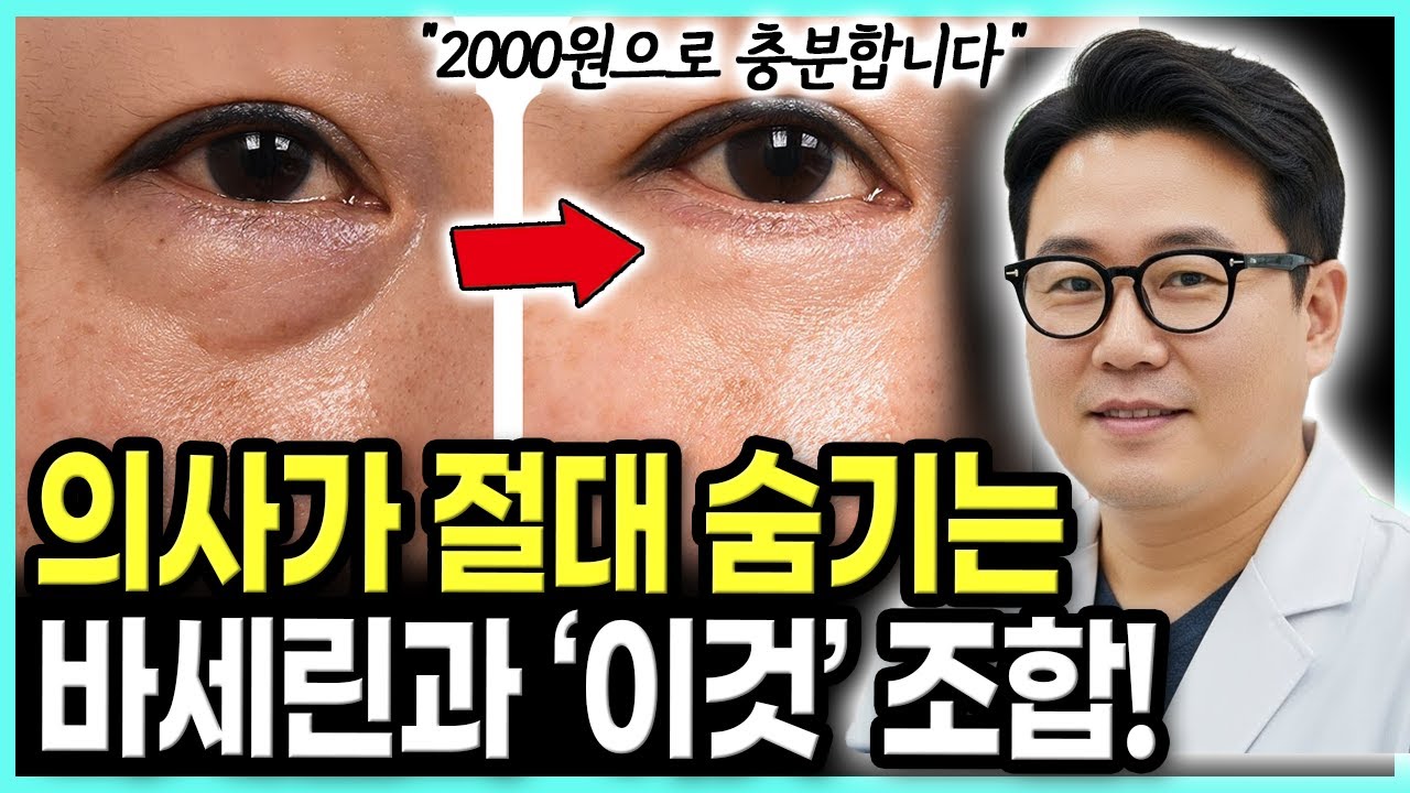 이곳에 바세린과 '이것' 바르세요 백화점 50만원 화장품 안부럽습니다. 피부과 의사는 절대 말하지않는 보습의 비밀 #건강정보 #건강지식