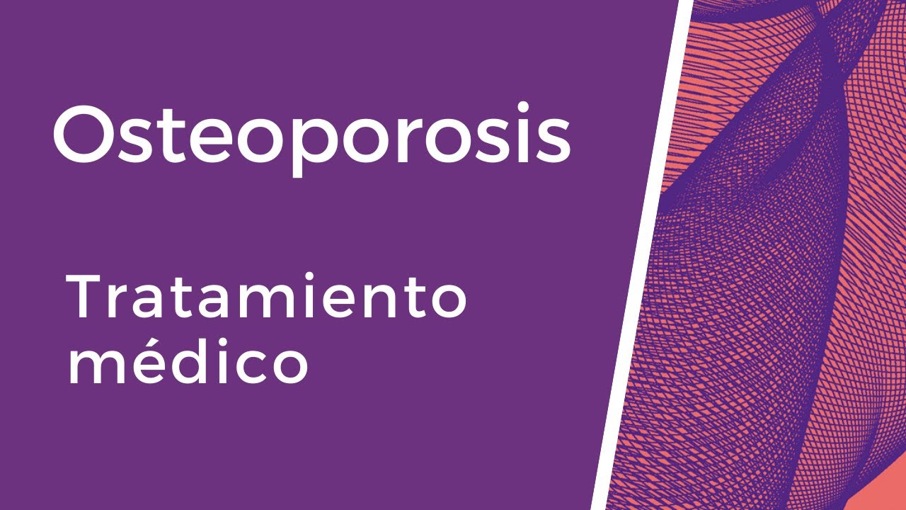 Tratamiento médico de la osteoporosis.